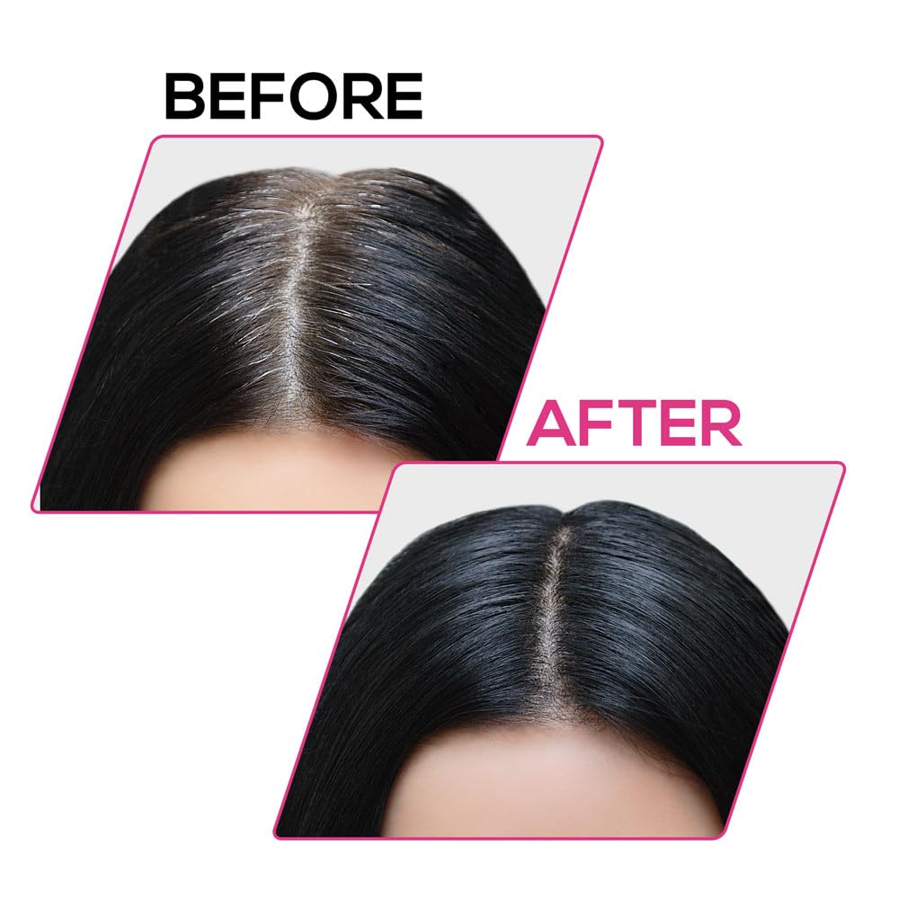 RENEE Cover-Up Hair Powder - Black | Covers Grey Roots & Bald Spots Instantly | Highly Pigmented, Fuller & Denser Look | Long-Lasting | Matte Finish | Fine Powder | Flawless Application | 4gm